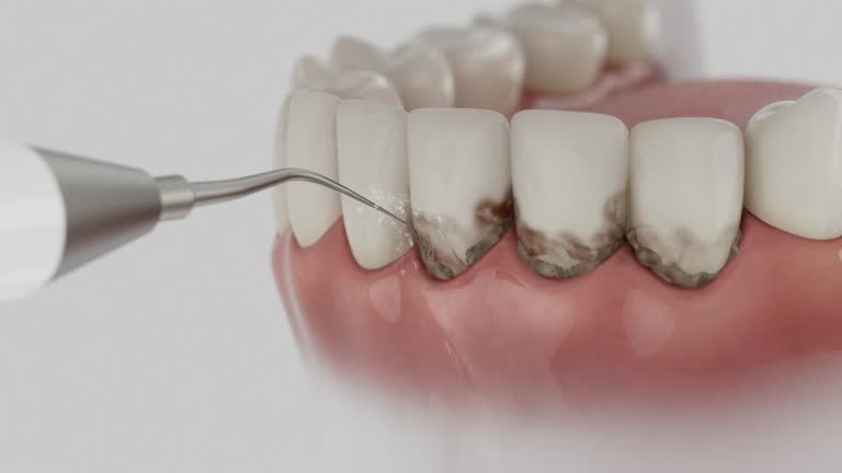 Reliable Emergency Dentist contractor in Eupora, MS by Smile Center Dentistry